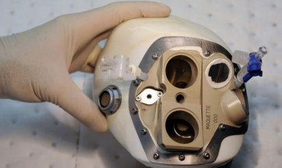 Carmat a bien implanté un 2e coeur artificiel