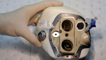 Carmat a bien implanté un 2e coeur artificiel