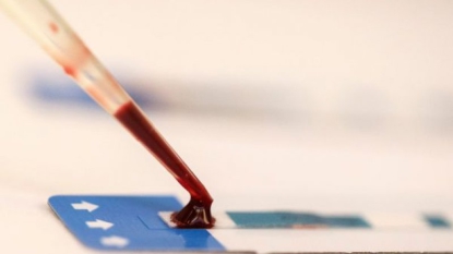 Sida: l’ADN de l’Homme serait capable de désactiver le virus