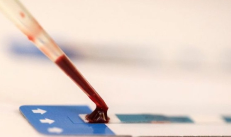 Sida: l’ADN de l’Homme serait capable de désactiver le virus