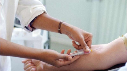 Des médecins français découvrent un nouveau mode de dépistage du cancer du poumon