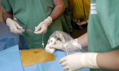 Le gouvernement prévoit de supprimer 22 000 postes en trois ans dans les hôpitaux