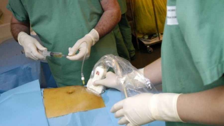 Le gouvernement prévoit de supprimer 22 000 postes en trois ans dans les hôpitaux