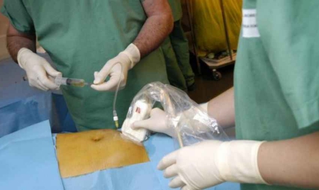 Le gouvernement prévoit de supprimer 22 000 postes en trois ans dans les hôpitaux