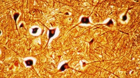 Bonne nouvelle, la greffe de neurones est désormais possible