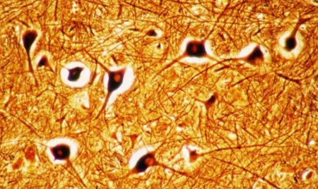 Bonne nouvelle, la greffe de neurones est désormais possible