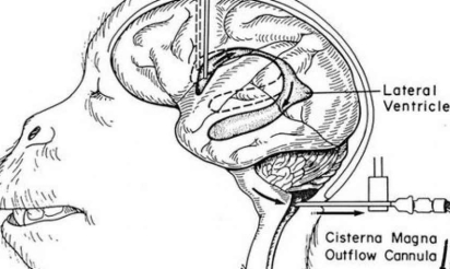 Un projet de transplantation de tête humaine laisse les spécialistes sceptiques