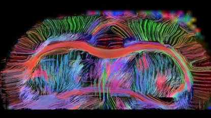 Reconstituer un bout de cerveau de rat en laboratoire, c’est (presque) possible