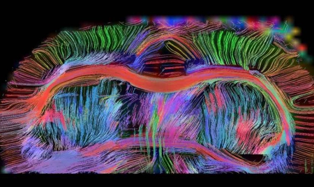 Reconstituer un bout de cerveau de rat en laboratoire, c’est (presque) possible