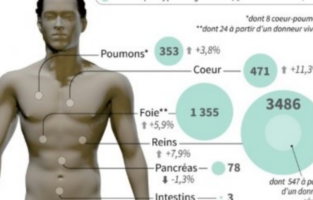 Médecine: les greffes d'organes progressent au rythme de 15 par jour 
